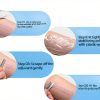 Ksndurn Skin Marker Pen Fine Point Surgical Marker 4 Pack Clear White-3